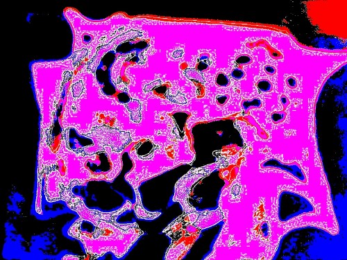 micro001m.jpg
